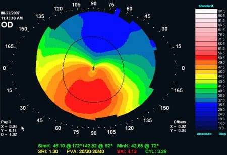 The Eye Practice's New Website is Live - The Eye Practice